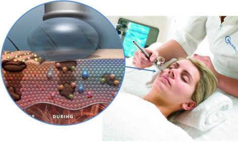 applicationmethod.jpg applicationmethod.jpg